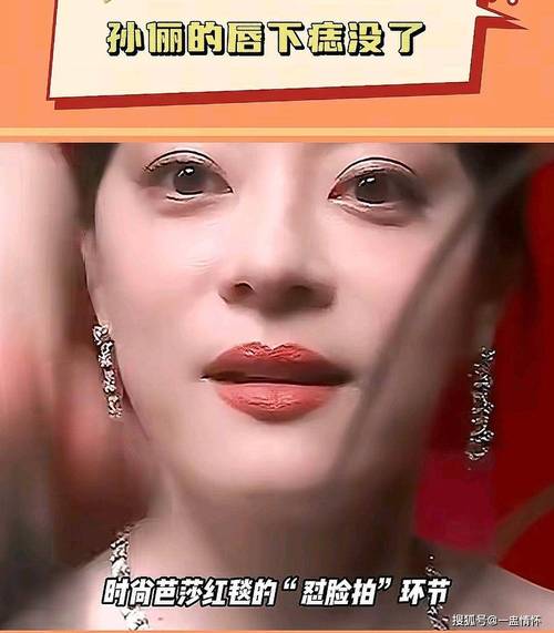 2025全年免费资料大全和孙俪唇下痣没了与孙俪嘴唇的痣